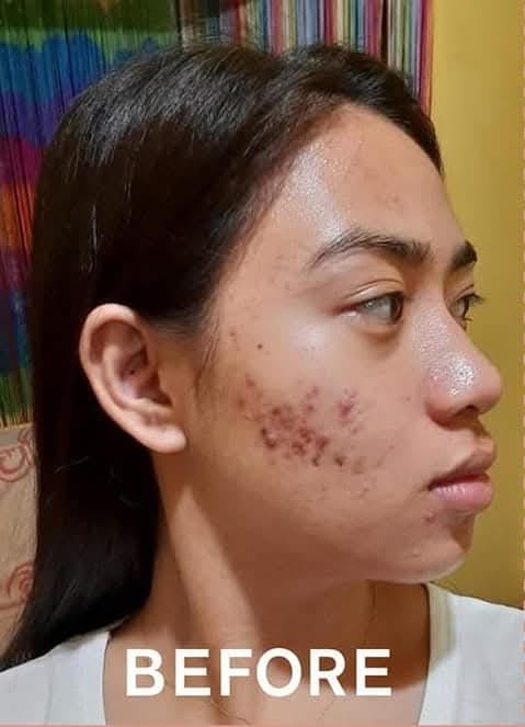 Beautederm Canadawide Distributor by Jaz Beautebox